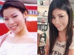<b>泰星整容前后对比照第2缉 速度来围观！泰星整容大变脸组图2</b>