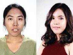 韩国整容电视节目整容改造泰国美女