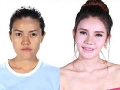 泰国人造美女韩国整容大变身 前后对比照你敢认吗？