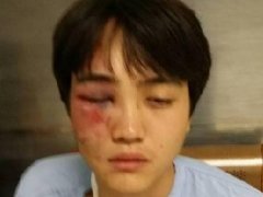 泰国清迈再曝黑势力围殴学生 踩断手踢爆眼残忍至极