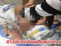 整形需谨慎! 泰国变性人隆胸药物过敏身亡!